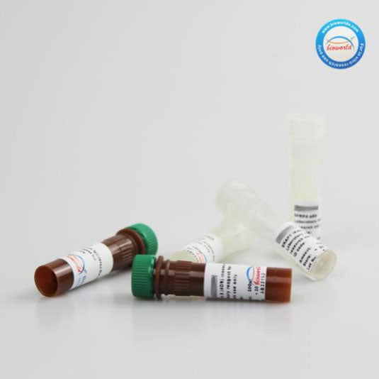Mouse Alpha-fetoglobulin ELISA Kit - CEK2049