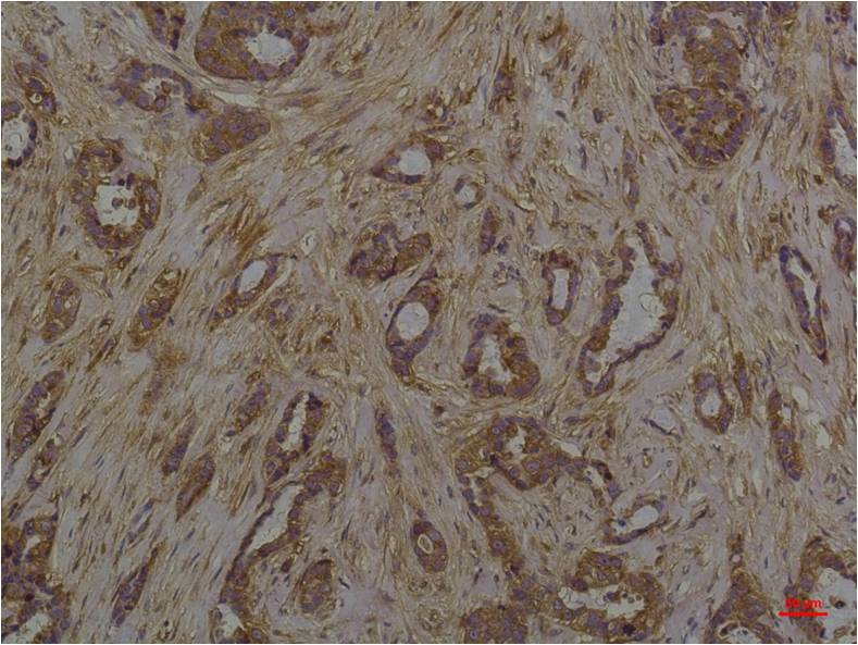 Phosphoserine Mouse Monoclonal Antibody - EM1189