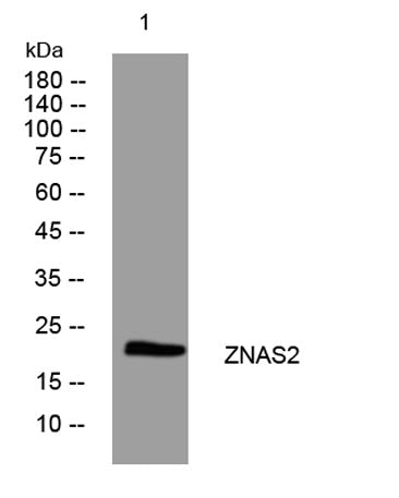 ZNAS2 Rabbit Polyclonal Antibody - ES12092