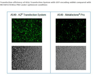 K2® Transfection System - DNA & RNA Transfection - T060