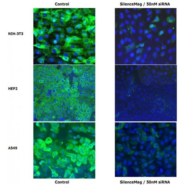 SilenceMag siRNA Delivery Reagent