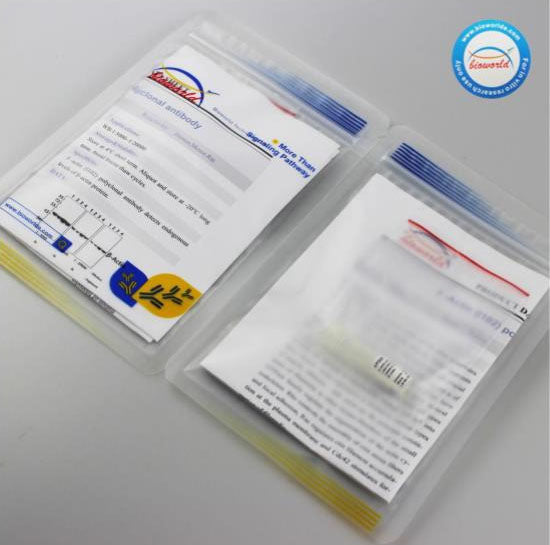 CD137  Polyclonal Antibody - NCP0263P