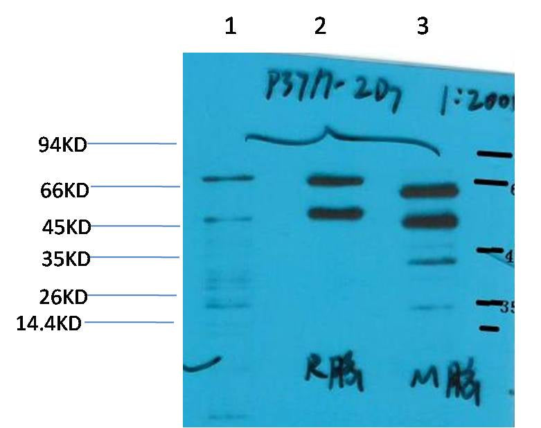 Phosphoserine Mouse Monoclonal Antibody - EM1189