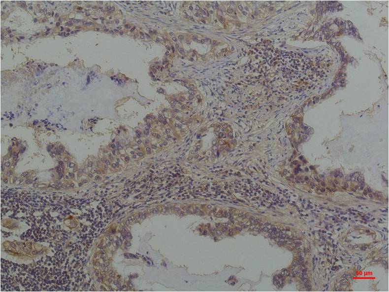 Phosphoserine Mouse Monoclonal Antibody - EM1189