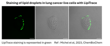 Load image into Gallery viewer, LipiTrace - Fluorescent Marker for Lipid Droplets - IDY-LIPI-250