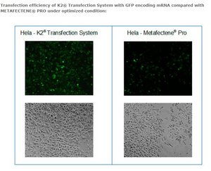 K2® Transfection System - DNA & RNA Transfection - T060